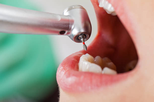Best Same-Day Emergency Dentist in La Cygne, KS